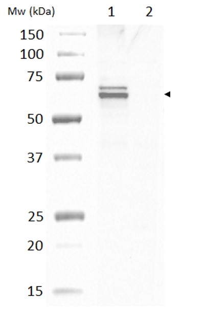Western blot - Anti-GAD65 + GAD67 antibody (AB11070), expandable thumbnail