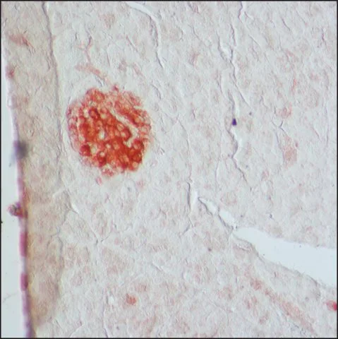 Immunohistochemistry (Formalin/PFA-fixed paraffin-embedded sections) - Anti-GAD65 + GAD67 antibody (AB49832)