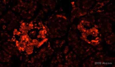 Immunohistochemistry (Formalin/PFA-fixed paraffin-embedded sections) - Anti-GAD65 + GAD67 antibody (AB49832), expandable thumbnail