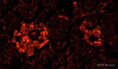 Immunohistochemistry (Formalin/PFA-fixed paraffin-embedded sections) - Anti-GAD65 + GAD67 antibody (AB49832)