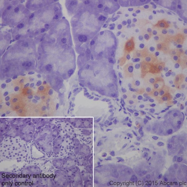 Immunohistochemistry (Formalin/PFA-fixed paraffin-embedded sections) - Anti-GAD65 + GAD67 antibody [EPR19366] - BSA and Azide free (AB240280), expandable thumbnail