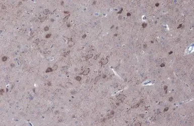 Immunohistochemistry (Formalin/PFA-fixed paraffin-embedded sections) - Anti-GAD67/GAD1 (AB97739)