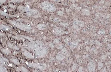 Immunohistochemistry (Formalin/PFA-fixed paraffin-embedded sections) - Anti-GAD67/GAD1 (AB97739)