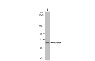 Western blot - Anti-GAD67/GAD1 (AB97739)