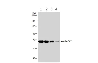 Western blot - Anti-GAD67/GAD1 (AB97739)