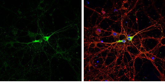 Immunocytochemistry/ Immunofluorescence - Anti-GAD67/GAD1 antibody (AB228710), expandable thumbnail
