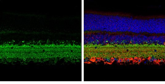 Immunohistochemistry (Formalin/PFA-fixed paraffin-embedded sections) - Anti-GAD67/GAD1 antibody (AB228710), expandable thumbnail