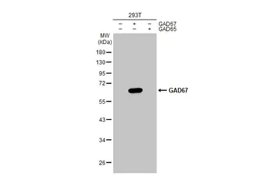 Western blot - Anti-GAD67/GAD1 antibody (AB228710)