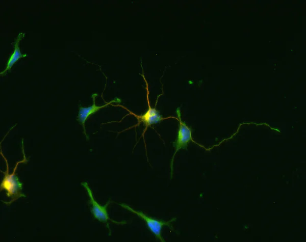 Immunocytochemistry/ Immunofluorescence - Anti-GAD67/GAD1 antibody (AB75712)