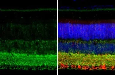 Immunohistochemistry (Formalin/PFA-fixed paraffin-embedded sections) - Anti-GAD67/GAD1 (AB97739)