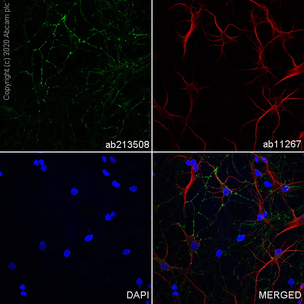 Immunocytochemistry/ Immunofluorescence - Anti-GAD67/GAD1 antibody [EPR20578] (AB213508)