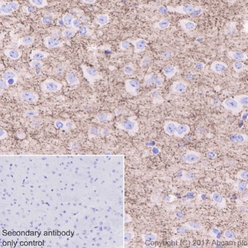 Anti-GAD67/GAD1 antibody [EPR20578]