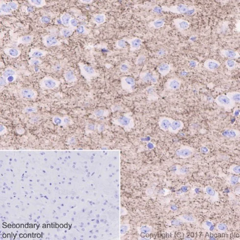 Anti-GAD67/GAD1 antibody [EPR20578] (ab213508) | Abcam