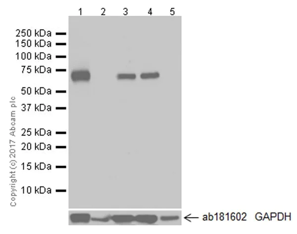 Western blot - Anti-GAD67/GAD1 antibody [EPR20578] (AB213508)
