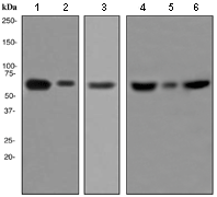 Western blot - Anti-GAD67/GAD1 antibody [EPR2550] (AB108626), expandable thumbnail