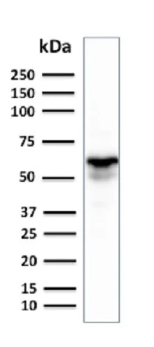 Western blot - Anti-GAD67/GAD1 antibody [GAD1/2391] (AB237998)
