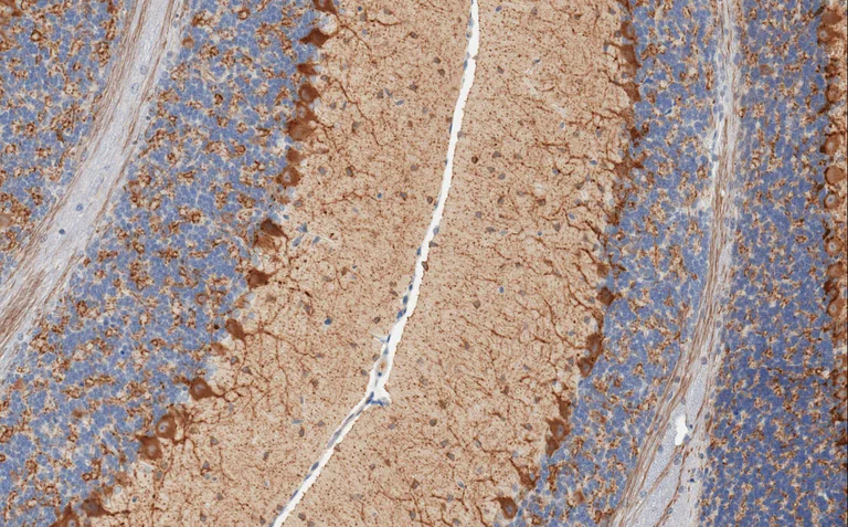 Immunohistochemistry (Formalin/PFA-fixed paraffin-embedded sections) - Anti-GAD67/GAD1 antibody [K-87] (AB26116)