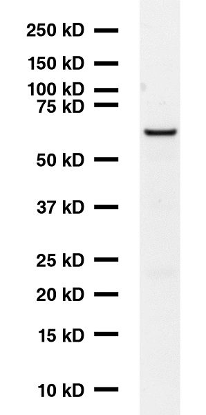 Western blot - Anti-GAD67/GAD1 antibody [K-87] (AB26116), expandable thumbnail