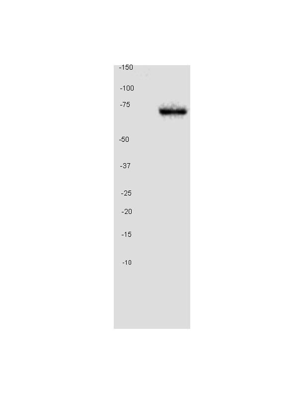 Western blot - Anti-GAD67/GAD1 antibody [K-87] (ab26116), expandable thumbnail