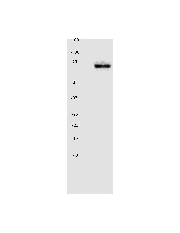 Western blot - Anti-GAD67/GAD1 antibody [K-87] (AB26116)