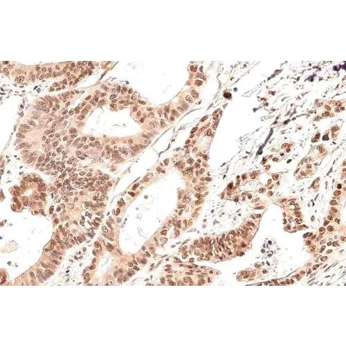 Immunohistochemistry (Formalin/PFA-fixed paraffin-embedded sections) - Anti-GADD153 antibody [HL2262] (AB317182)