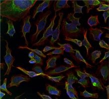 Immunocytochemistry/ Immunofluorescence - Anti-GADD34 antibody (AB175355)