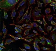 Immunocytochemistry/ Immunofluorescence - Anti-GADD34 antibody (AB175355)