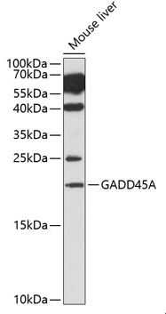 Western blot - Anti-GADD45A antibody (AB180768), expandable thumbnail