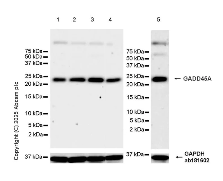 Western blot - Anti-GADD45A antibody [EPR29021-87] (AB323808)