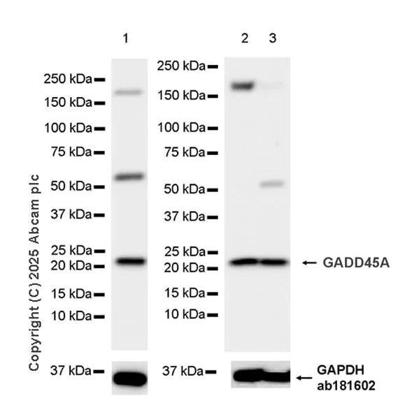 Western blot - Anti-GADD45A antibody [EPR29021-87] (AB323808)
