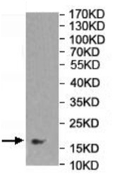 Western blot - Anti-GADD45B antibody (AB205252), expandable thumbnail