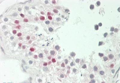 Immunohistochemistry (Formalin/PFA-fixed paraffin-embedded sections) - Anti-GADD45B antibody - C-terminal (AB230646)