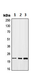 Western blot - Anti-GADD45B antibody - C-terminal (AB230646), expandable thumbnail