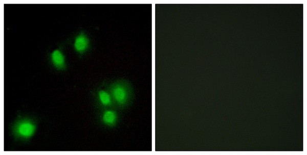 Immunocytochemistry/ Immunofluorescence - Anti-GADD45G/CR6 antibody (AB196774), expandable thumbnail