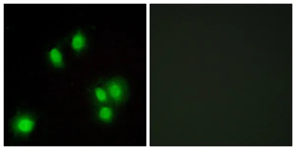 Immunocytochemistry/ Immunofluorescence - Anti-GADD45G/CR6 antibody (AB196774)