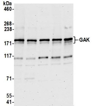 Western blot - Anti-GAK antibody (AB186120)