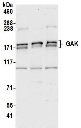 Western blot - Anti-GAK antibody (AB186120)