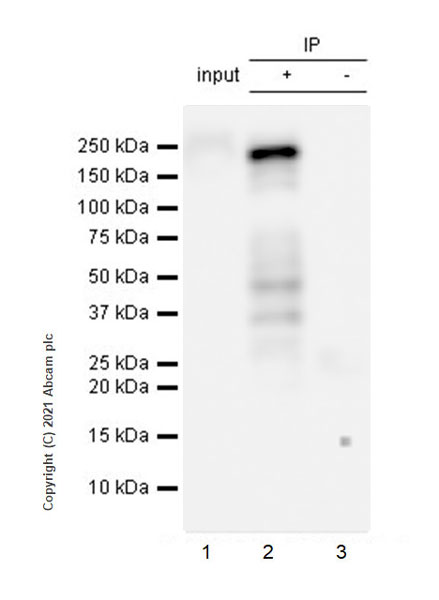 Immunoprecipitation - Anti-GAK antibody [EPR25327-102] (AB288566)