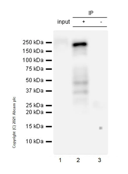 Immunoprecipitation - Anti-GAK antibody [EPR25327-102] - BSA and Azide free (AB288575)