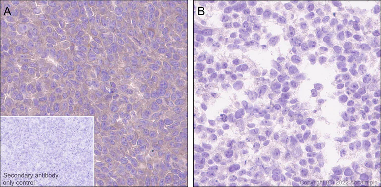 Immunohistochemistry (Formalin/PFA-fixed paraffin-embedded sections) - Anti-GAK antibody [EPR25327-39] - BSA and Azide free (AB305070)