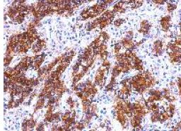 Immunohistochemistry (Formalin/PFA-fixed paraffin-embedded sections) - Anti-GAL4 antibody (AB154309), expandable thumbnail