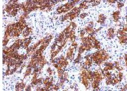 Immunohistochemistry (Formalin/PFA-fixed paraffin-embedded sections) - Anti-GAL4 antibody (AB154309)