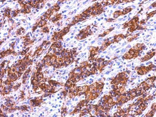 Immunohistochemistry (Formalin/PFA-fixed paraffin-embedded sections) - Anti-GAL4 antibody (AB229347)