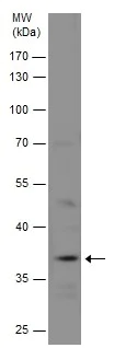 Western blot - Anti-GAL4 antibody (AB229347)