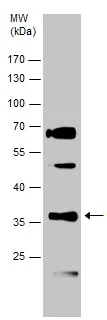 Western blot - Anti-GAL4 antibody (AB229347)