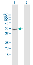 Western blot - Anti-Galactosidase alpha antibody (AB169315)