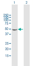 Western blot - Anti-Galactosidase alpha antibody (AB169315)