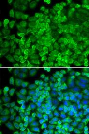 Immunocytochemistry/ Immunofluorescence - Anti-Galactosidase alpha antibody (AB230924)