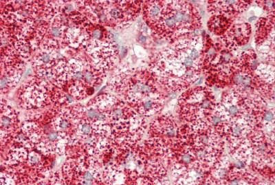 Immunohistochemistry (Formalin/PFA-fixed paraffin-embedded sections) - Anti-Galactosidase alpha antibody (AB230924)