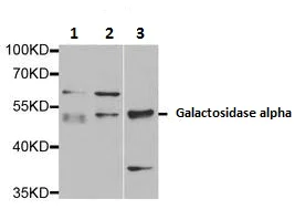 Western blot - Anti-Galactosidase alpha antibody (AB230924)